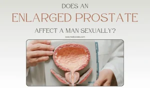 medicscales shop 39 Does An Enlarged Prostate Affect A Man Sexually
